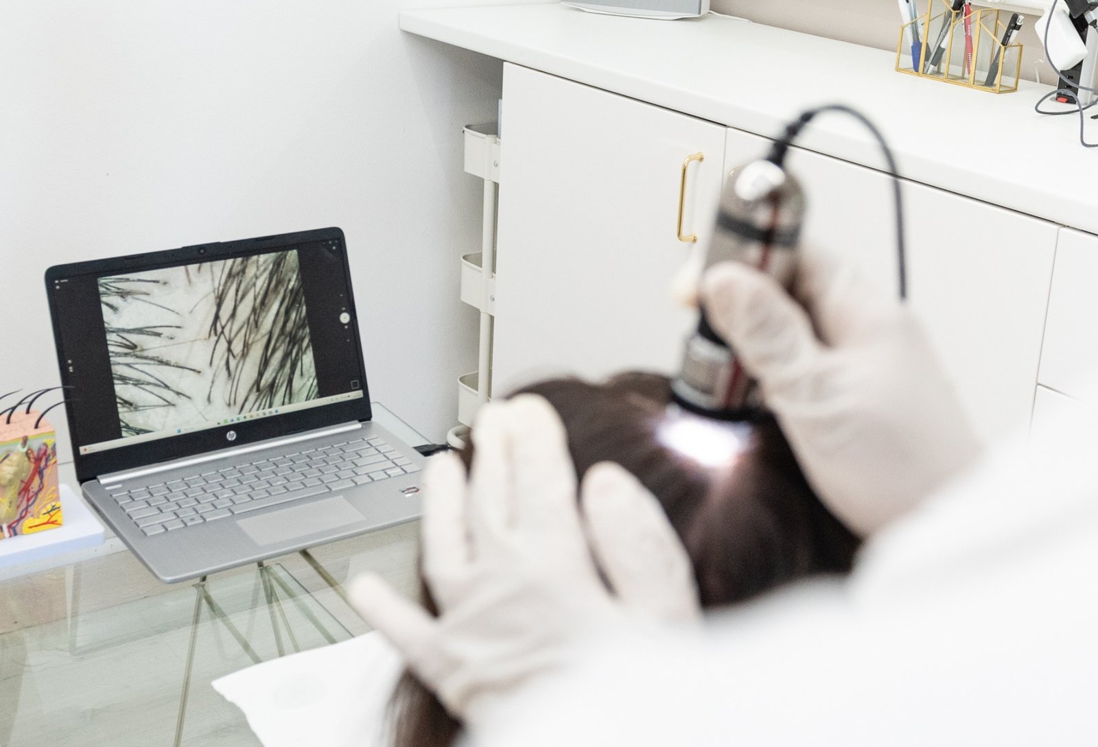 Kopfhautanalyse / Trichoskopie - Haartherapie & Kopfhautpflege - Nürnberg (20)